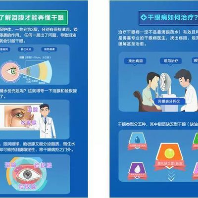 爱尔光润干眼治疗技术